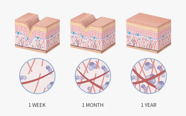 Функция-LED-Beauty